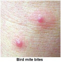Bird Mite Bites